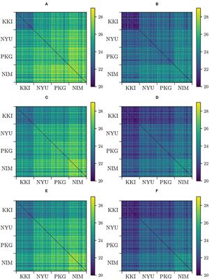 Riemannian Geometry of Functional Connectivity Matrices for Multi-Site Attention-Deficit/Hyperactivity Disorder Data Harmonization